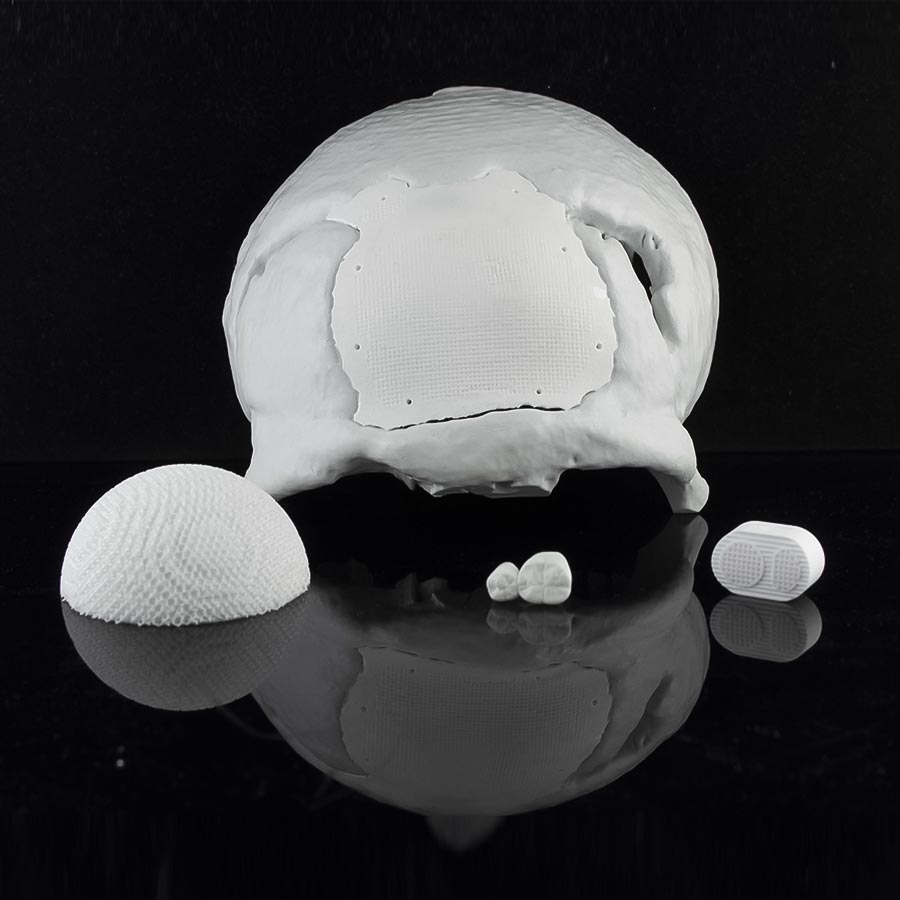 Hydroxyapatite 3D Printing Paste