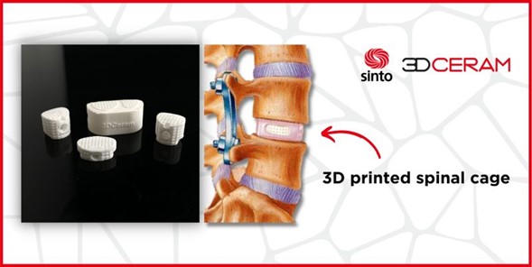 Additive-Plus-3D-printed-spinal-cage-examples