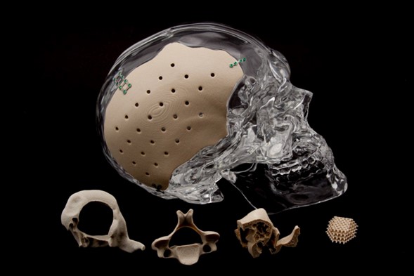 Additive-Plus-PEEK-3D-printed-implants