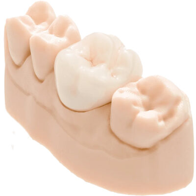 Saremco-Print-CROWNTEC-Materials-e1715765489416