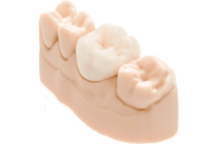 Saremco-Print-CROWNTEC-Materials-e1715765489416